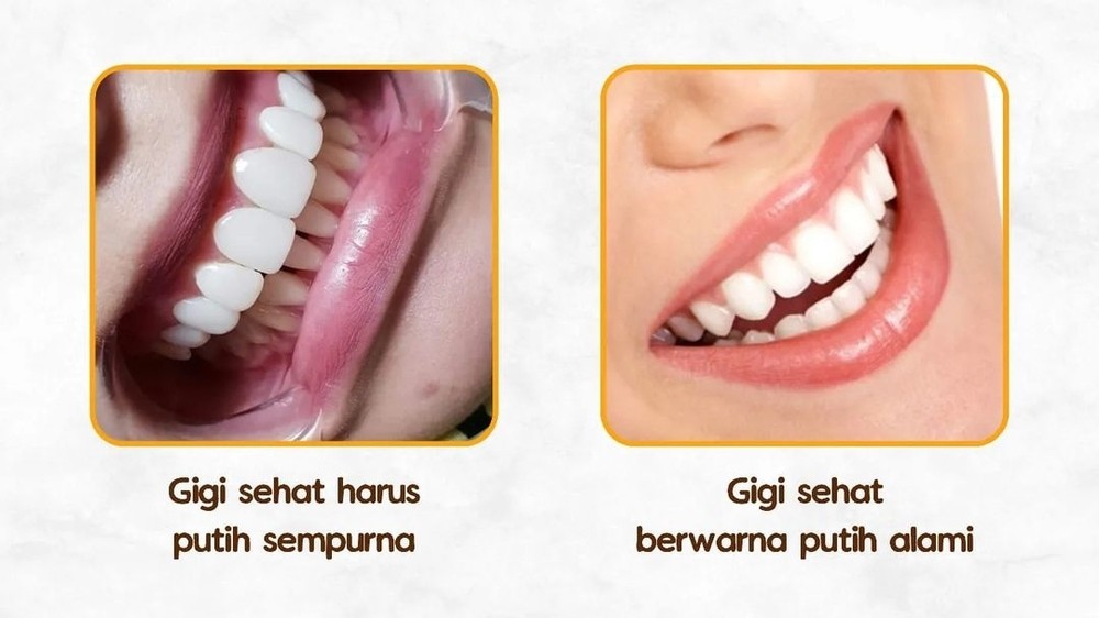 Menjaga Kesehatan Gigi dan Mulut, 8 Tips Perawatan yang Baik