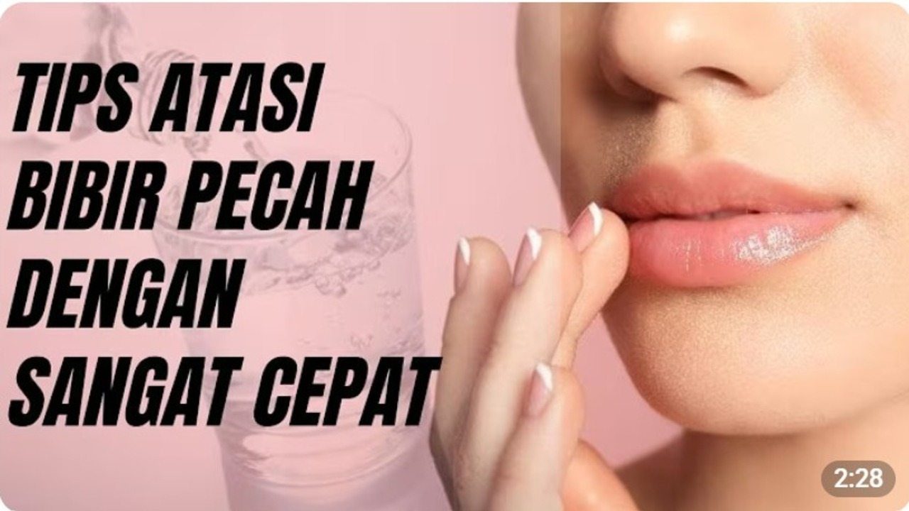Bibir Pecah-Pecah Bikin Tidak Nyaman? Ini Cara Mengatasinya dengan Bahan Alami