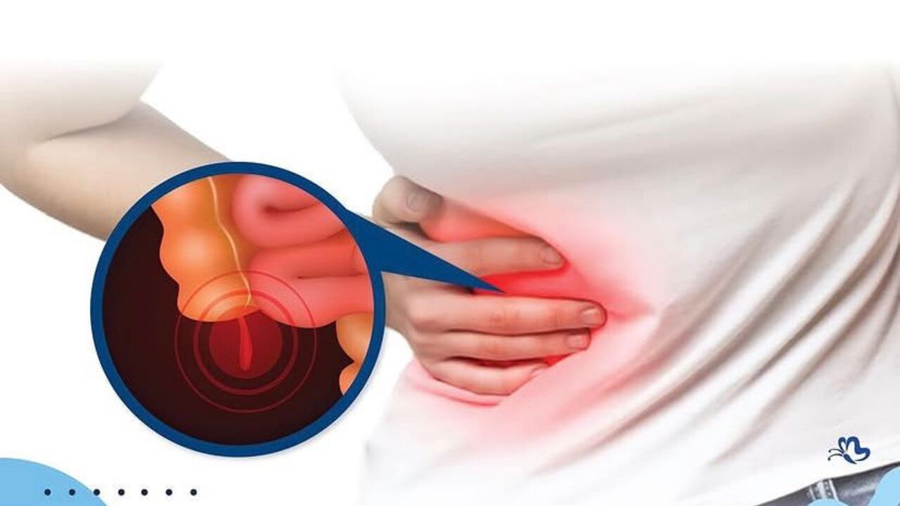 Fungsi Sebenarnya dari Usus Buntu pada Tubuh