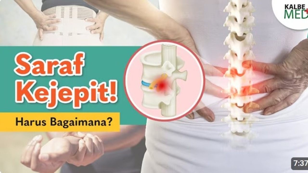 Jangan Disepelekan! Syaraf Terjepit Bisa Berujung Lumpuh, Simak Gejala dan Solusinya