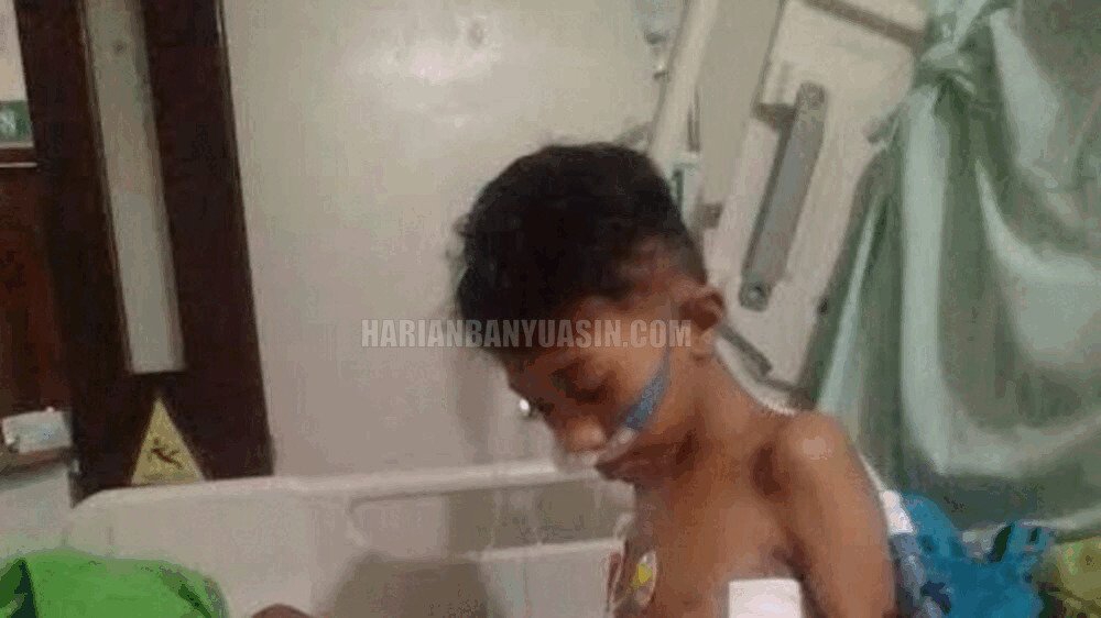 Derita Kanker Tulang, Kaki Bocah 13 Tahun di Banyuasin Sumatera Selatan Diamputasi