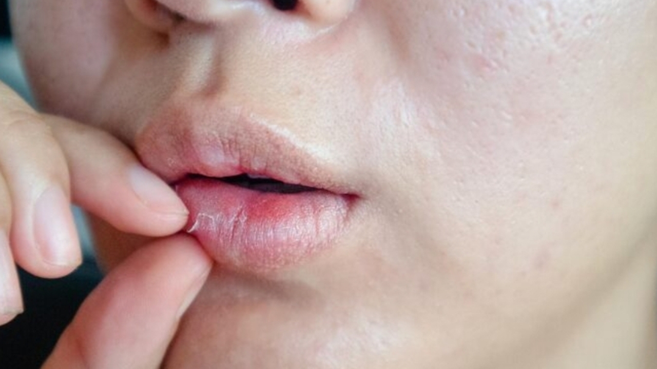 Ingin Tampil Cantik? Atasi Bibir Kering dengan 6 Cara Sederhana Ini!