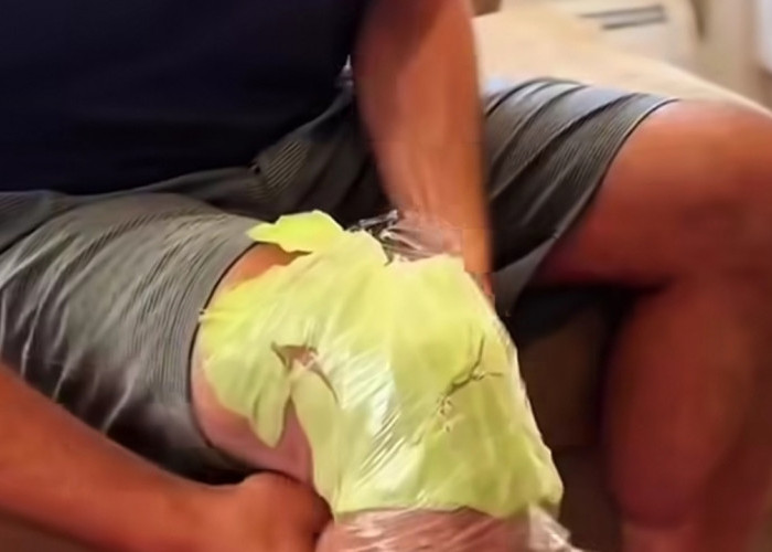 Viral Cara Orang Eropa Atasi Nyeri Sendi, Hanya Modal Daun Kubis Rebus