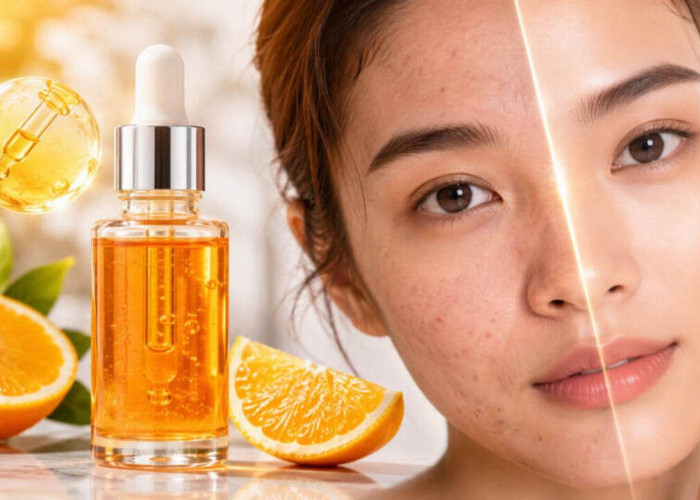 Serum Vitamin C Terbaik 2026 untuk Kulit Kusam & Bekas Jerawat, Nomor 1 Bikin Wajah Auto Glowing?