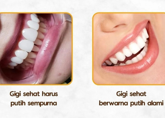 Menjaga Kesehatan Gigi dan Mulut, 8 Tips Perawatan yang Baik
