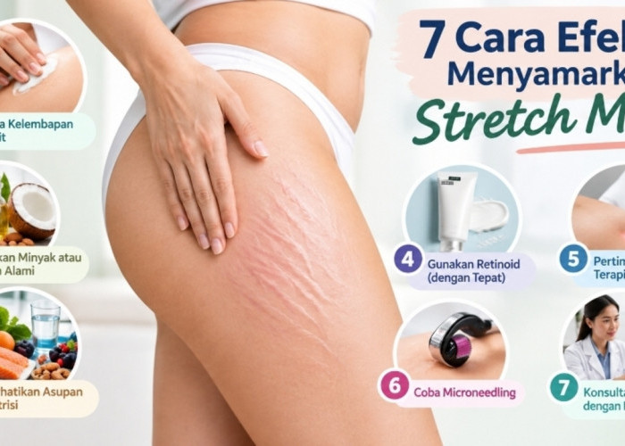 7 Cara Efektif Menyamarkan Stretch Mark, dari Pelembap hingga Perawatan Laser