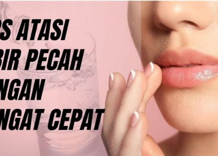 Bibir Pecah-Pecah Bikin Tidak Nyaman? Ini Cara Mengatasinya dengan Bahan Alami