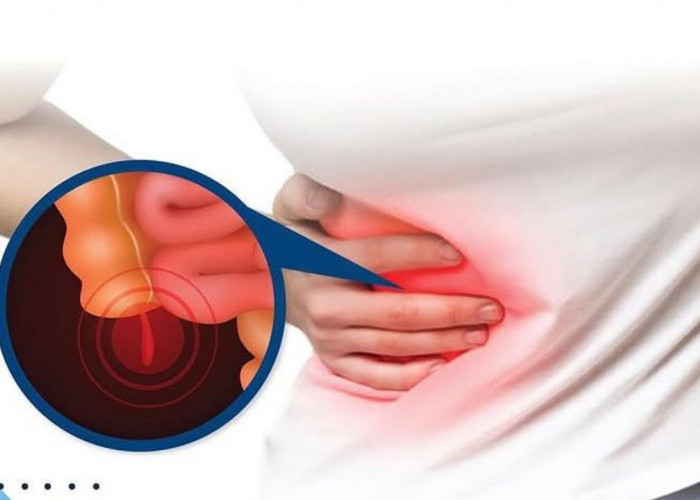 Fungsi Sebenarnya dari Usus Buntu pada Tubuh