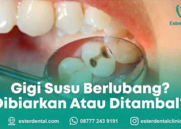 Gigi Susu Berlubang, Gimana Sih Sebaiknya? Yuk Cari Tahu!