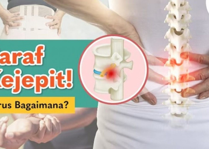 Jangan Disepelekan! Syaraf Terjepit Bisa Berujung Lumpuh, Simak Gejala dan Solusinya