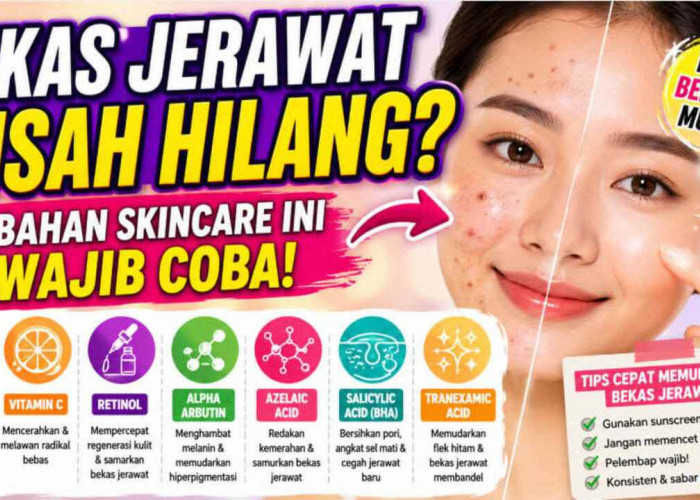  Bahan Skincare Ampuh Hilangkan Bekas Jerawat, Wajib Ada dalam Rutinitas Perawatan Kulit!