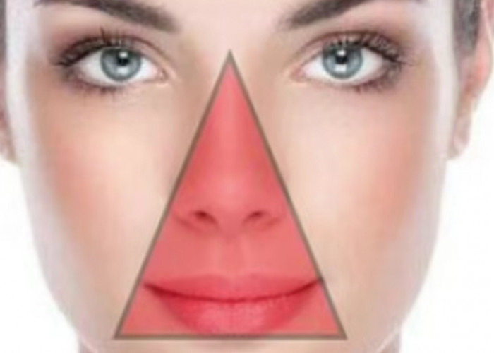 Memencet Jerawat Bisa Berakibat Fatal? Kenali Segitiga Berbahaya di Wajah