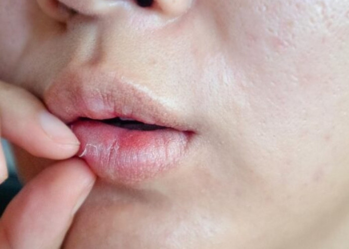 Ingin Tampil Cantik? Atasi Bibir Kering dengan 6 Cara Sederhana Ini!
