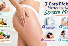 7 Cara Efektif Menyamarkan Stretch Mark, dari Pelembap hingga Perawatan Laser