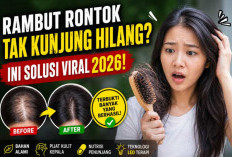 Rambut Rontok Tak Kunjung Hilang? Jangan Panik! Solusi Viral 2026 Ini Bikin Banyak Orang Kaget