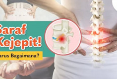 Jangan Disepelekan! Syaraf Terjepit Bisa Berujung Lumpuh, Simak Gejala dan Solusinya