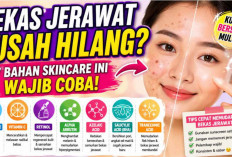  Bahan Skincare Ampuh Hilangkan Bekas Jerawat, Wajib Ada dalam Rutinitas Perawatan Kulit!