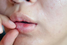 Ingin Tampil Cantik? Atasi Bibir Kering dengan 6 Cara Sederhana Ini!